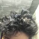  ,   Morquik, 22 ,   ,   