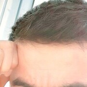  ,  Baxa, 34