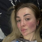 ���������� ����, �����