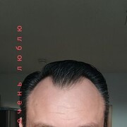  Bottrop,   Boris, 45 ,     , c 