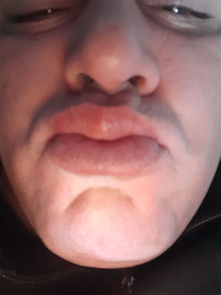  32225263  , 43 ,    -