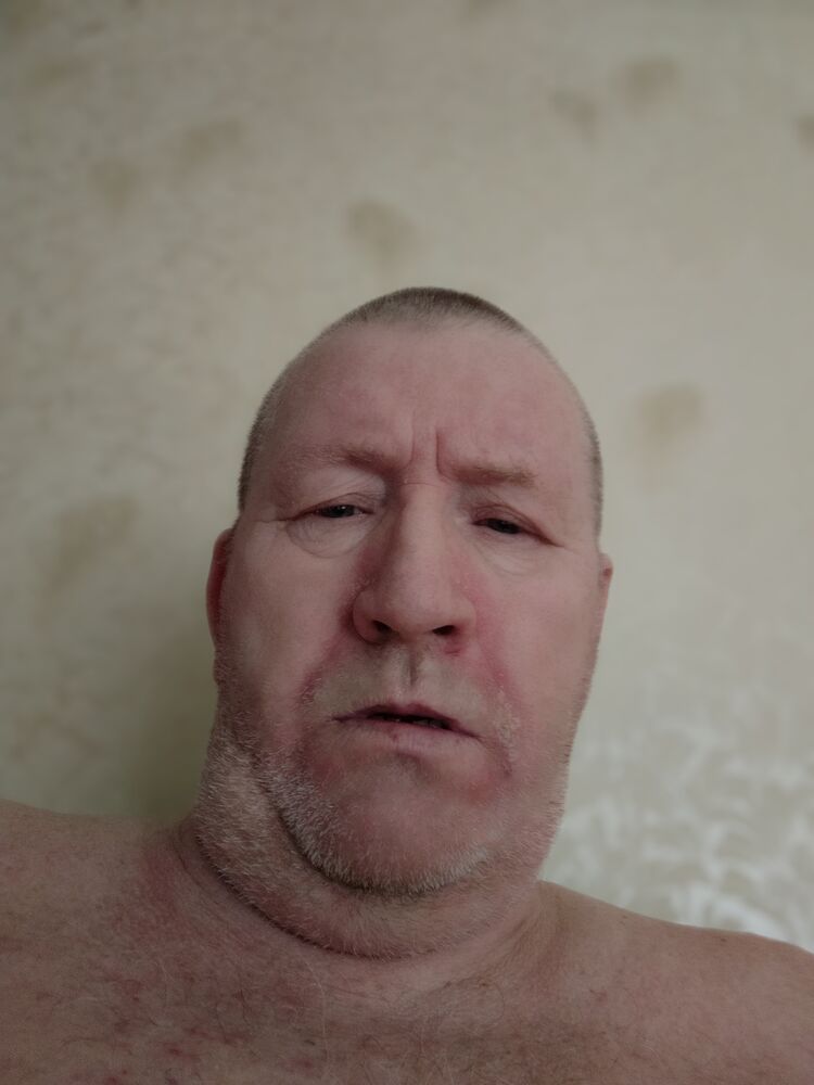  38552283  , 62 ,    