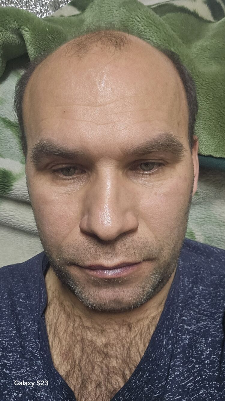  49257713  , 45 ,    