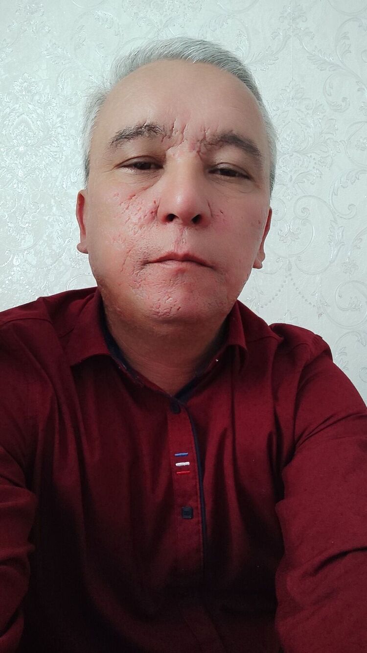  47848903  , 50 ,    