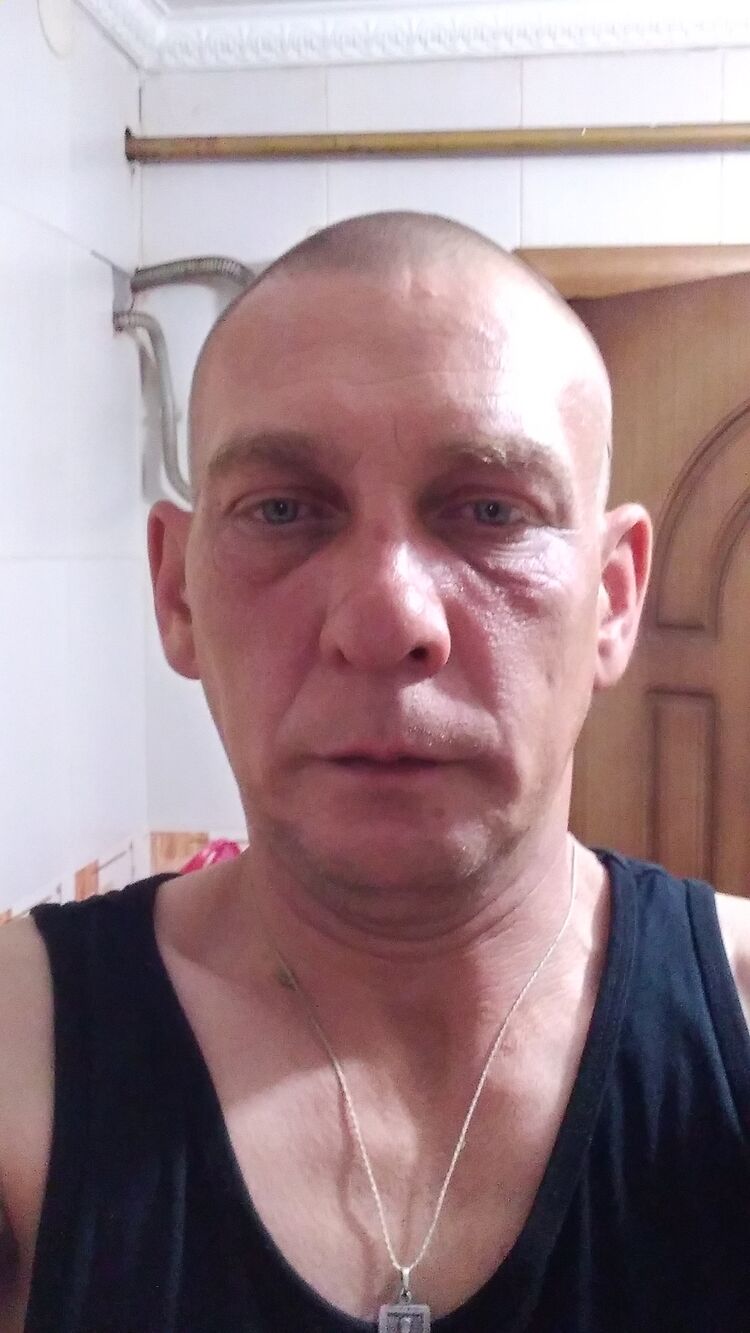  24553193  , 46 ,    