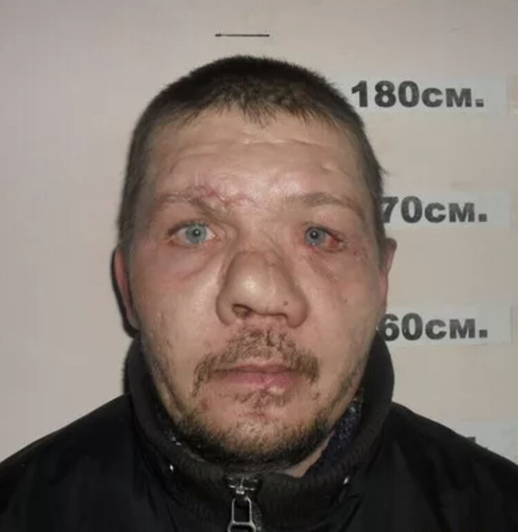  54180893  , 41 ,    -