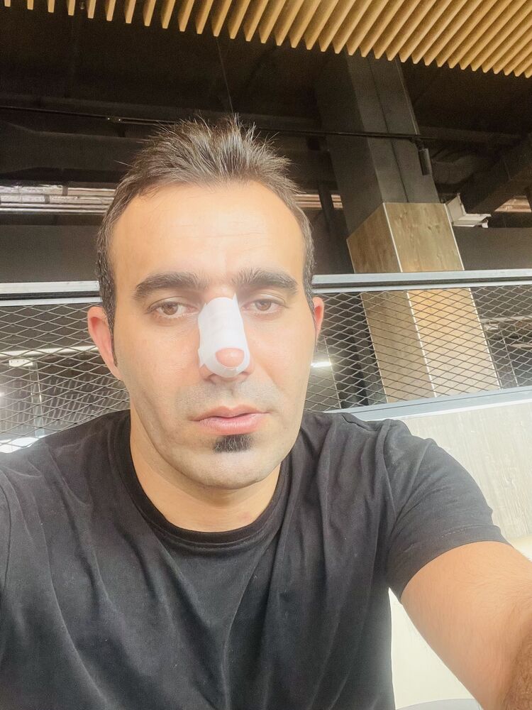 ���������� �����, ���� ������� ����, 35 ���, ������������ ��� ������, ����� � ���������