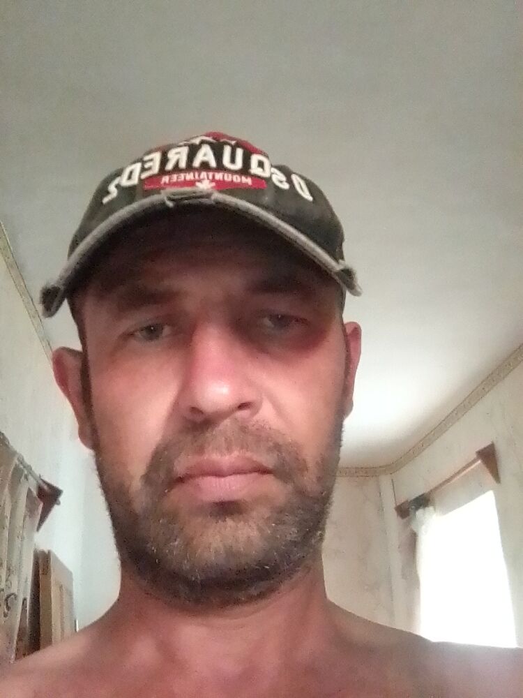  35508383  , 45 ,    