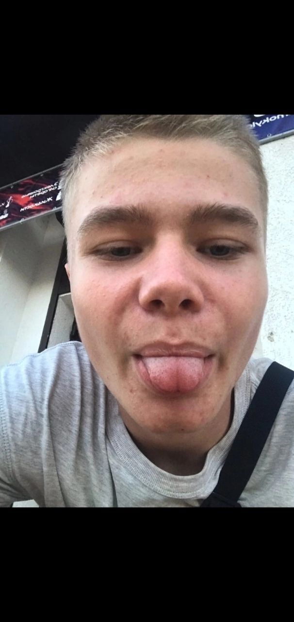 29798333  Alexander, 21 ,    