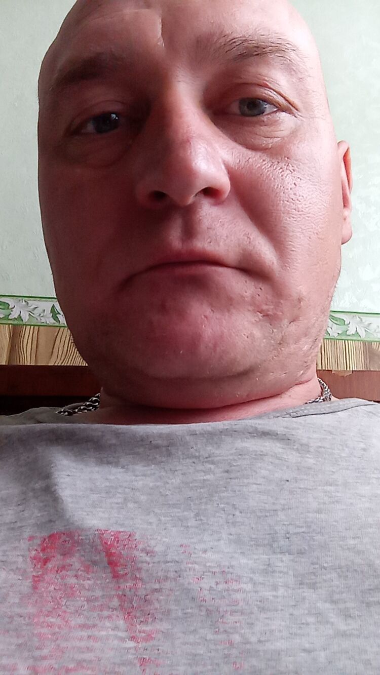  33851233  , 39 ,    --