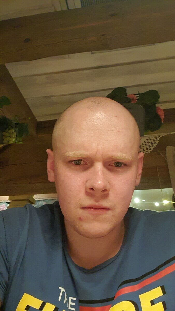  20392713  , 29 ,    