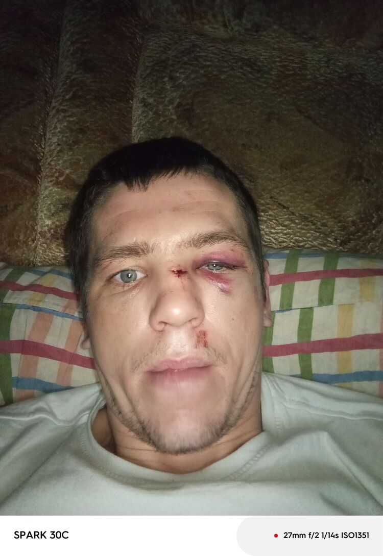  49441613  Denis, 34 ,    -