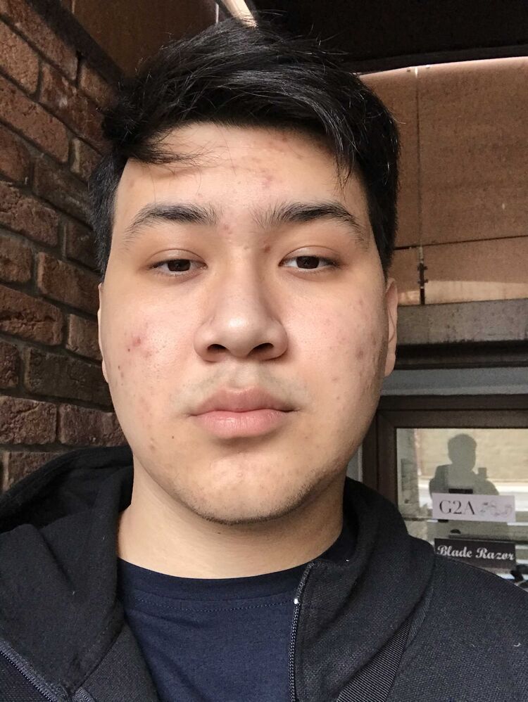  24136053  Nurlan, 22 ,    