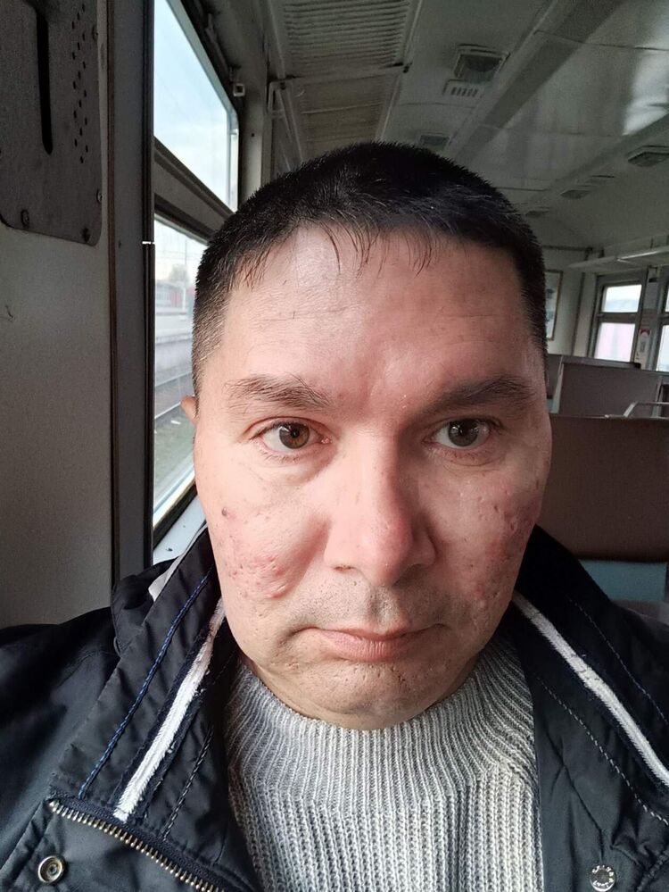 ���������� �����-���������, ���� ������� ���������, 49 ���, ������������ ��� c�������� ���������