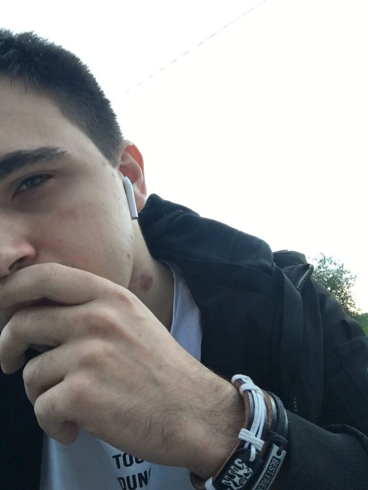  38808913  , 24 ,    