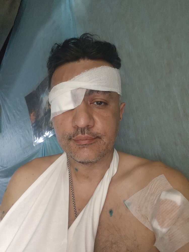 ���������� �����������, ���� ������� �����, 47 ���, ������������ ��� ������, ����� � ���������