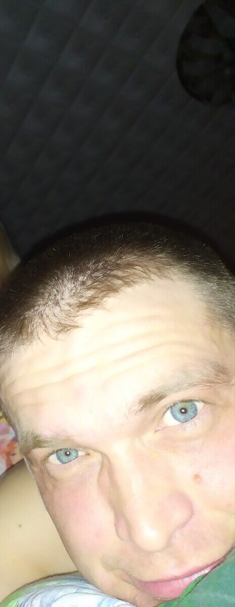  20595793  , 38 ,    