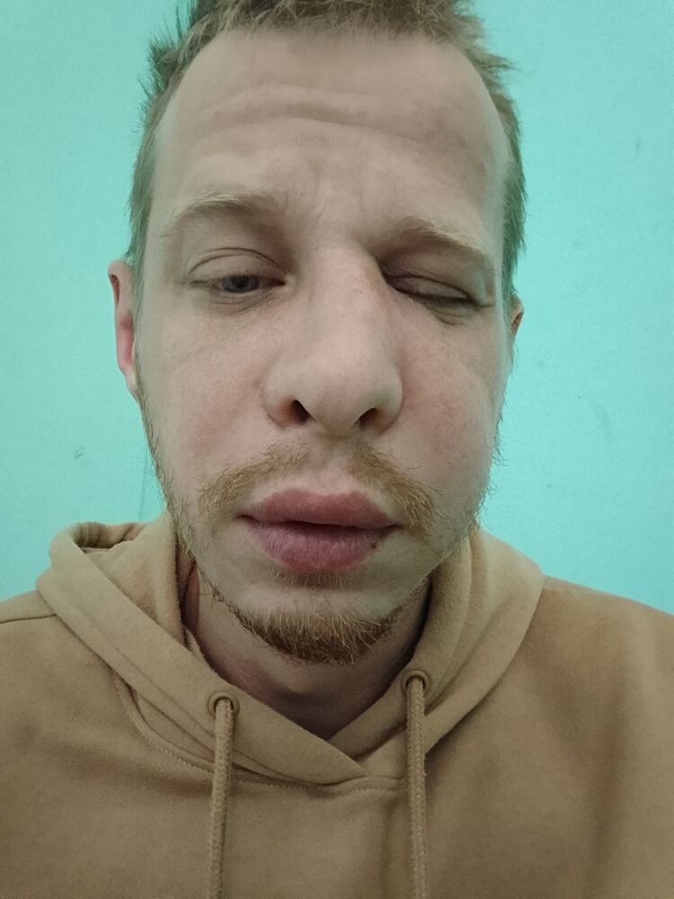  53232823  , 41 ,    -