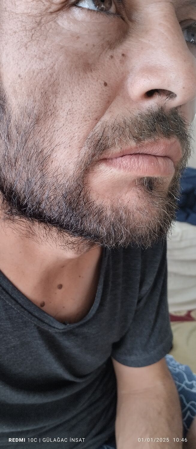  Etimesgut,   Yasar, 38 ,   ,   