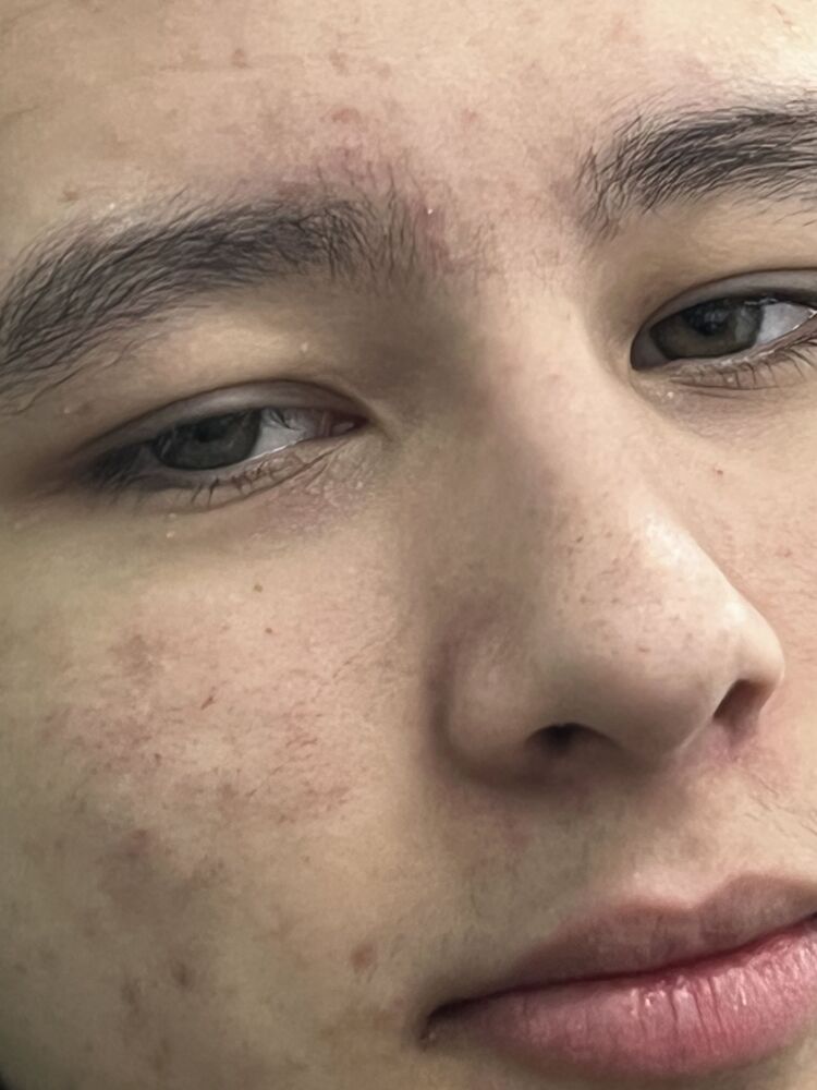 ���� 33478923 ����� ������, 21 ���, ���� ���������� � ��������������