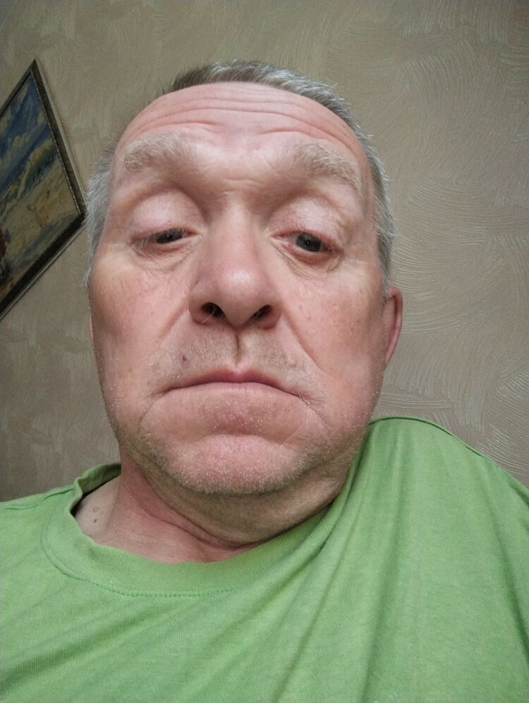  35446293  , 56 ,    