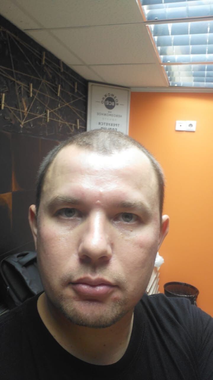 ���������� ������, ���� ������� ������, 35 ���, ������������ ��� ������, ����� � ���������