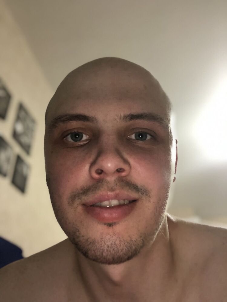  53249383  , 33 ,    