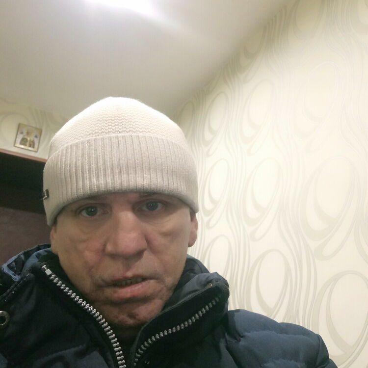  21983463  , 55 ,    
