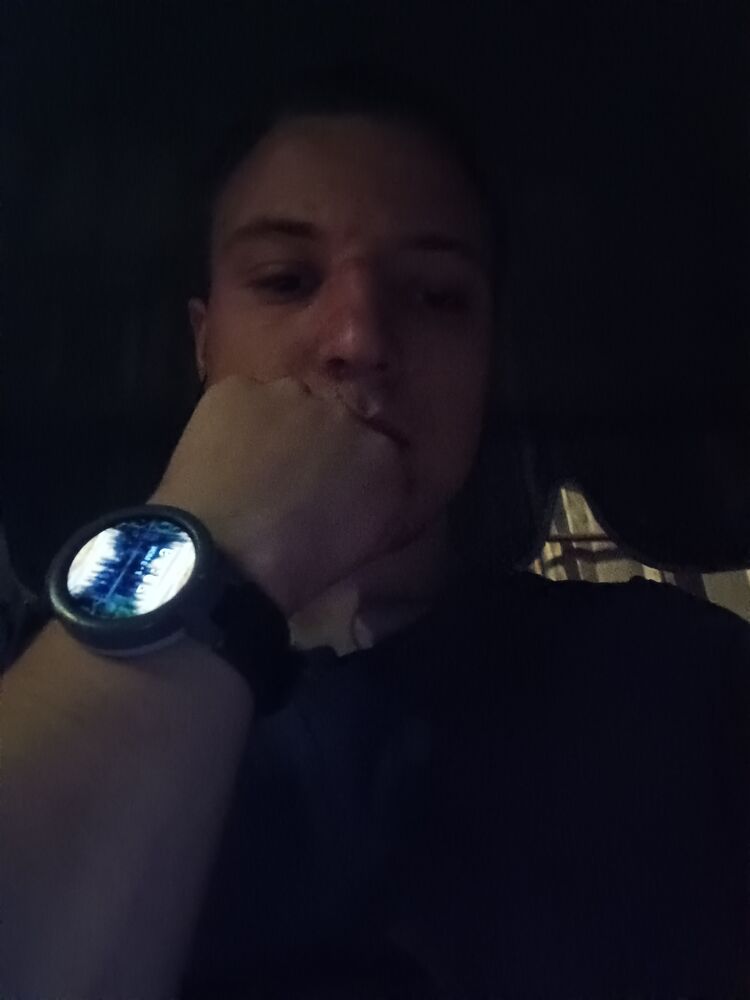  35696233   , 20 ,    