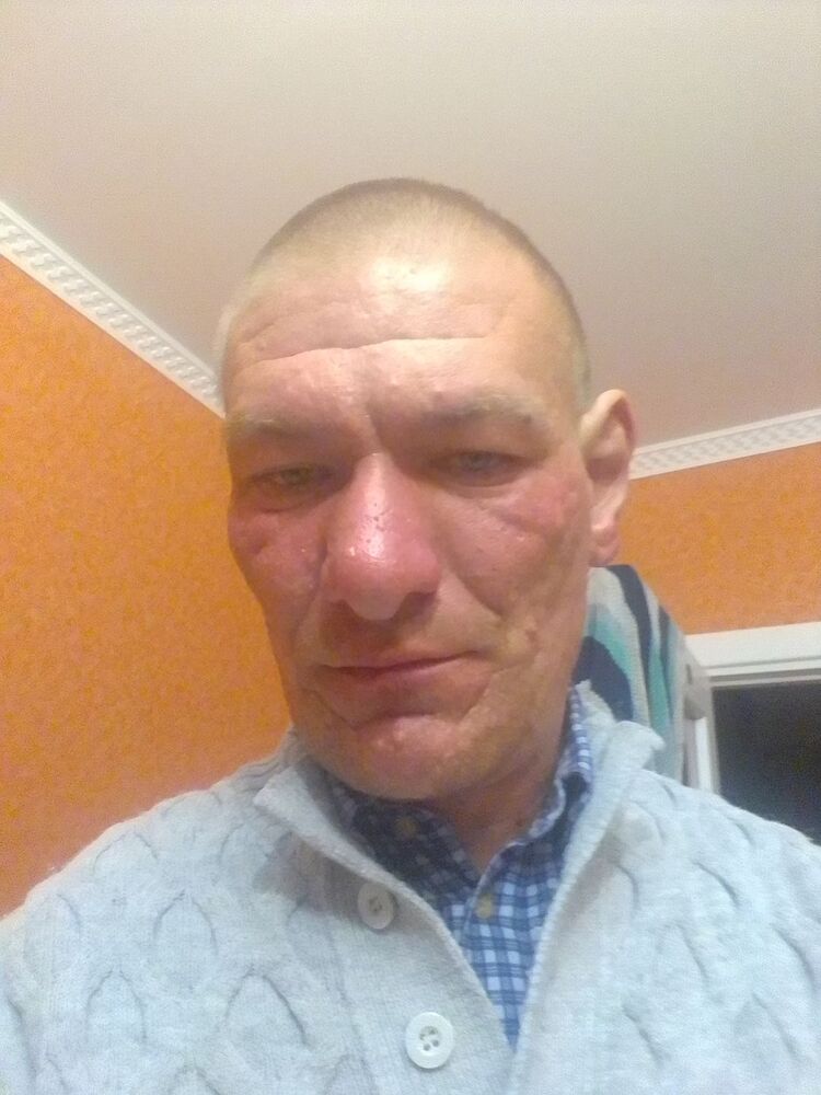  34232083  , 38 ,    