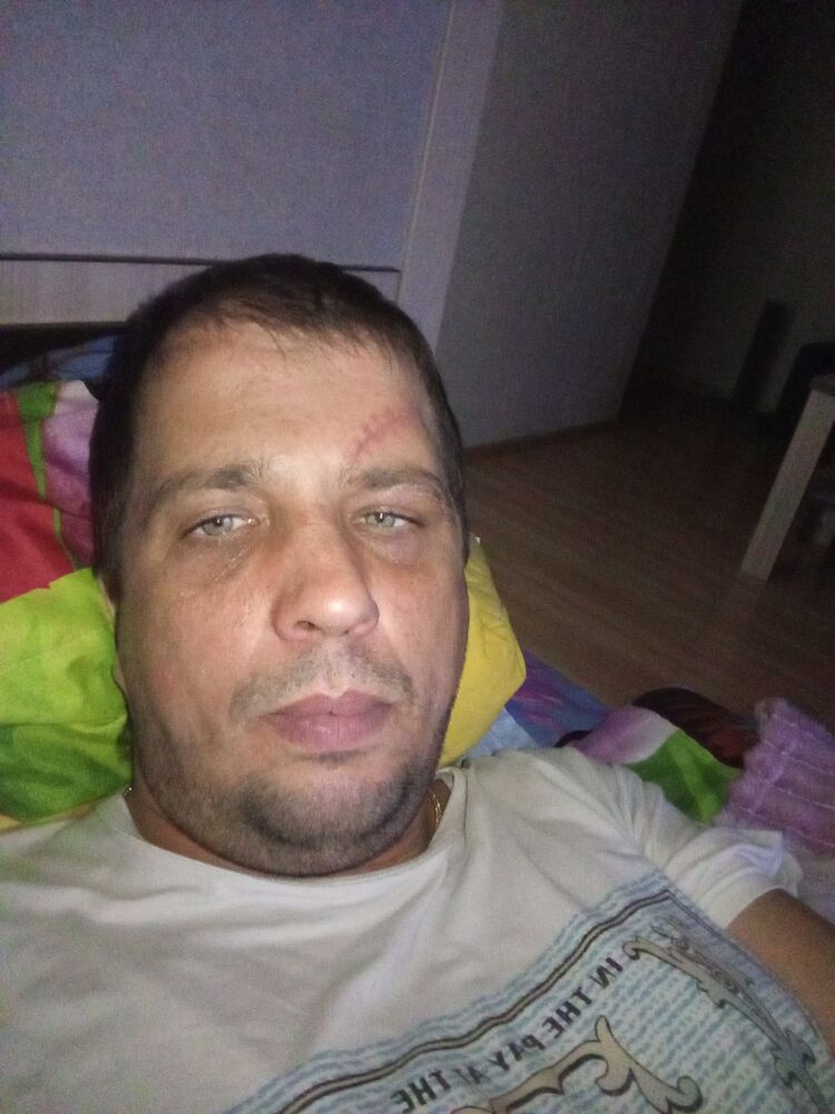  53529223  , 38 ,    --