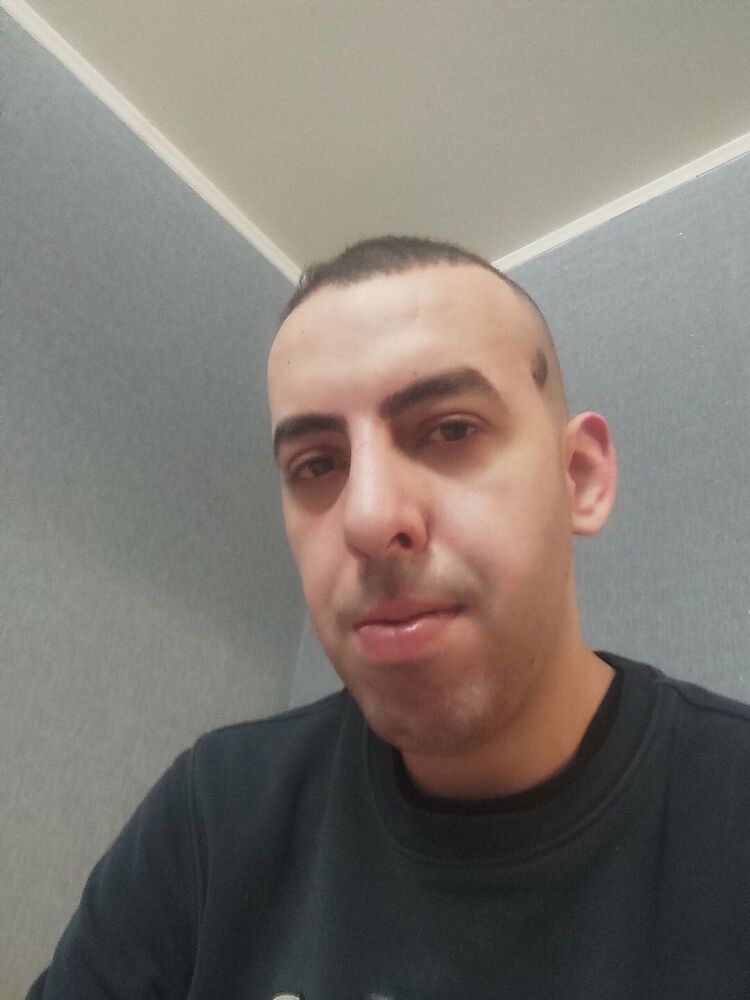  32355043  , 36 ,    