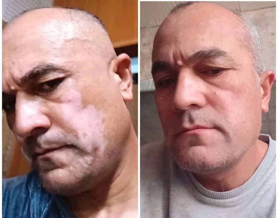 ,   , 65 ,   ,   