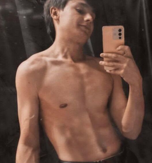 ���������� �������, ���� ����� Koma, 20 ���, ������������ ��� ������, ����� � ���������