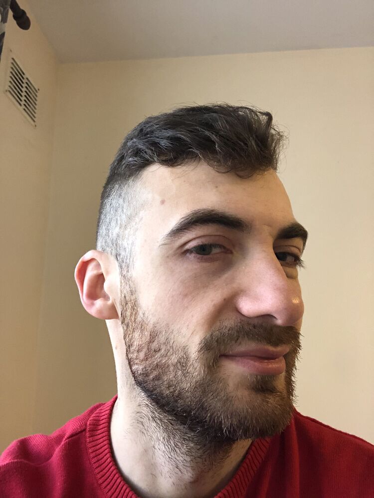  35984053  , 33 ,    