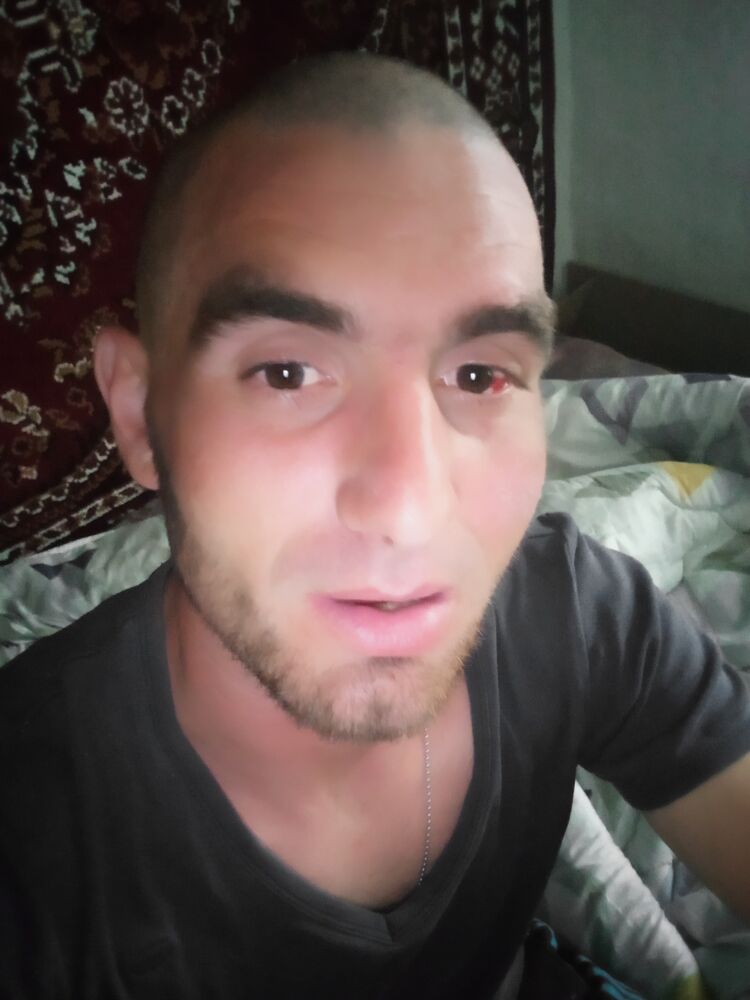  44149583  , 34 ,    