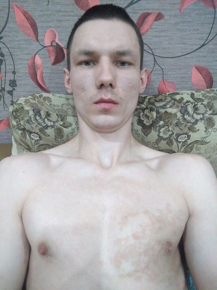  14940633  , 32 ,    