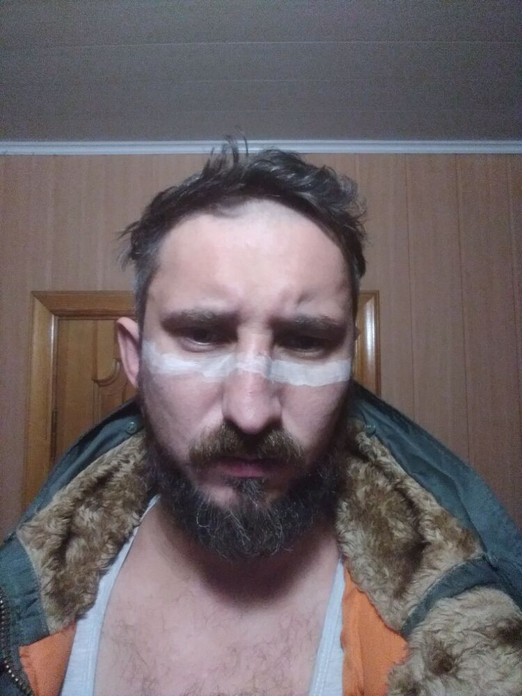  34349803  , 38 ,     