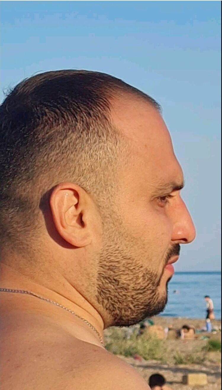  ,   Elchin, 36 ,     , 