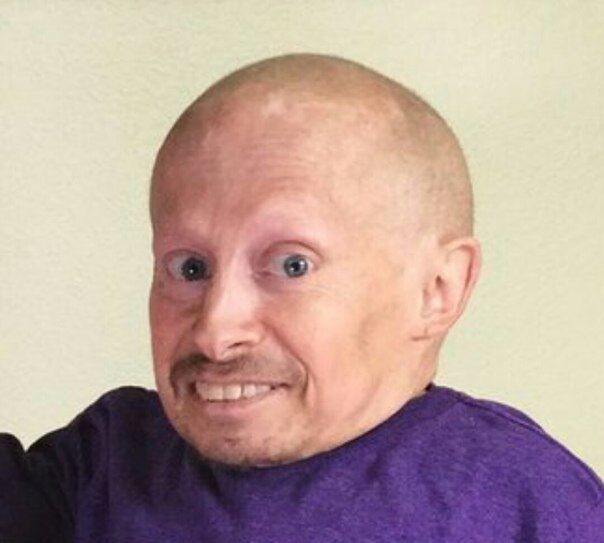  29661873  , 33 ,    