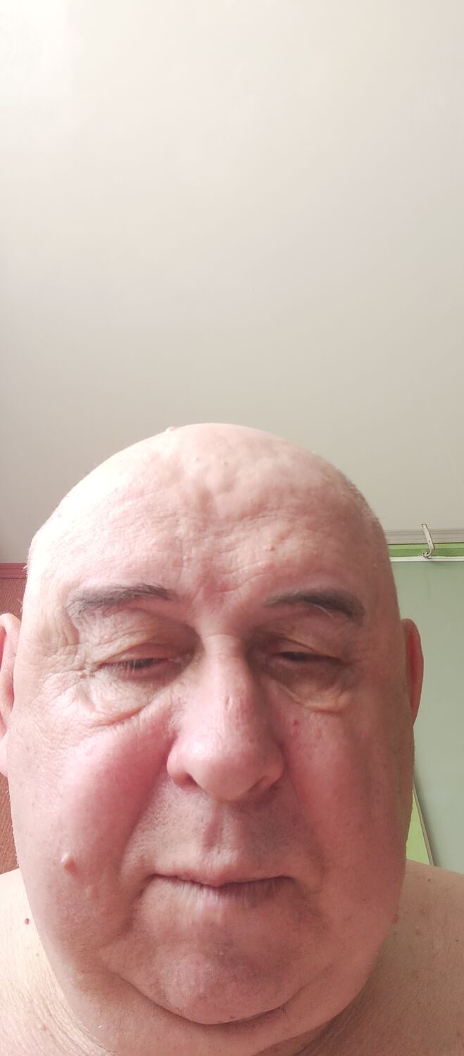  45941323  , 65 ,    
