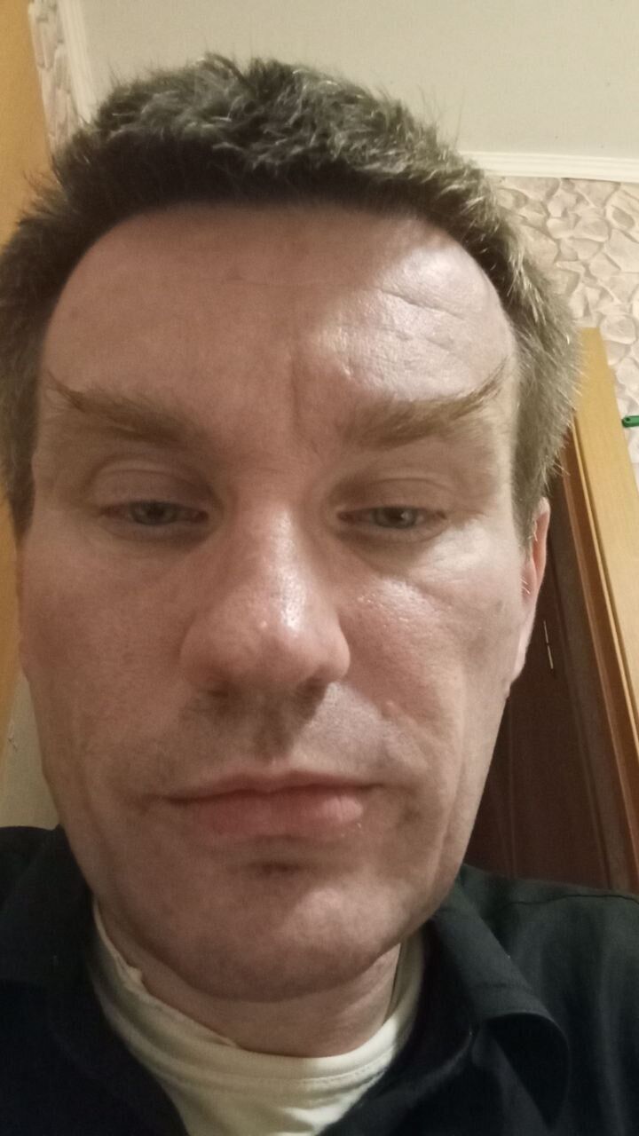  47359353  , 45 ,    