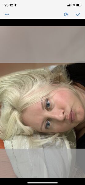  ,   NAT, 49 ,   ,   