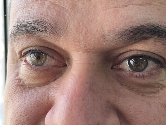  ,   Ayad, 46 ,   ,   