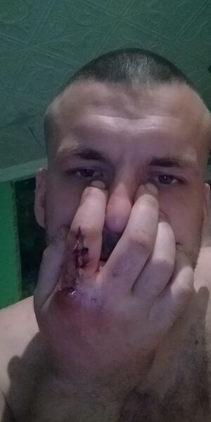  ,   RADION, 36 ,   